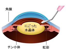 切開しているイラスト