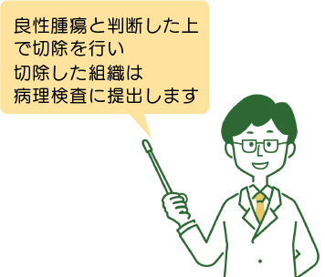 眼瞼腫瘍摘出術についてのイメージイラスト