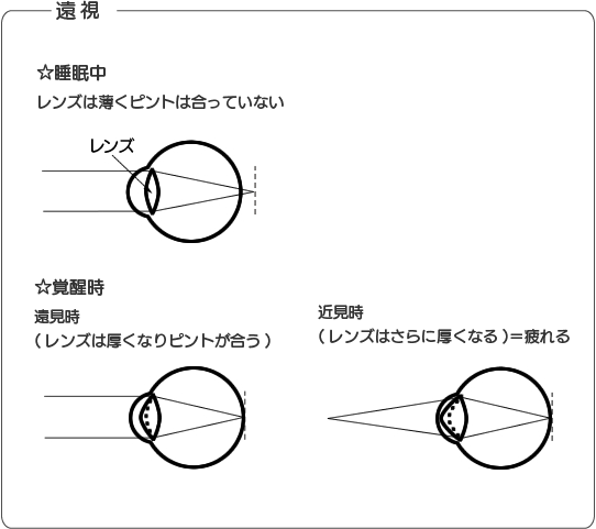 図：遠視