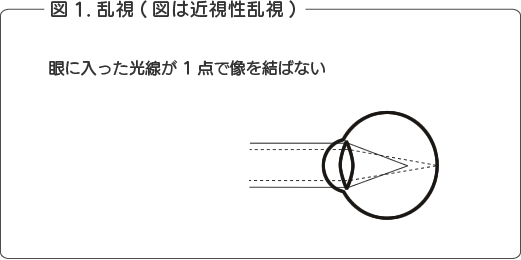図1
乱視（図は近視性乱視）