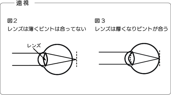 遠視の図