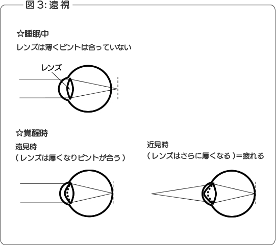 遠視の図